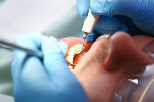 Best Weekend Emergency Dentist in Social Circle, GA