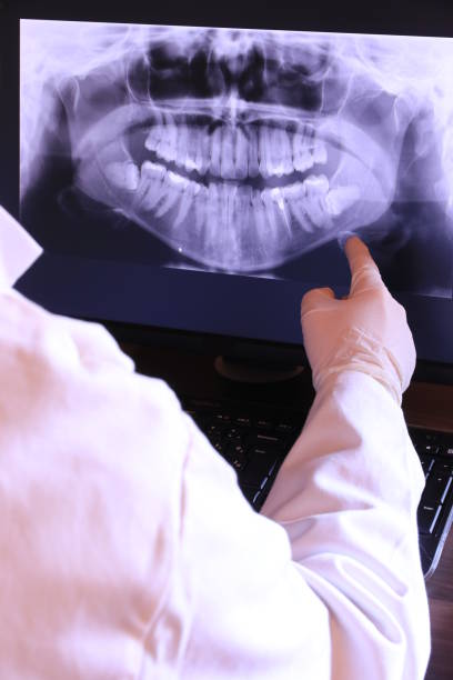 Best Emergency Tooth Extraction in Social Circle, GA