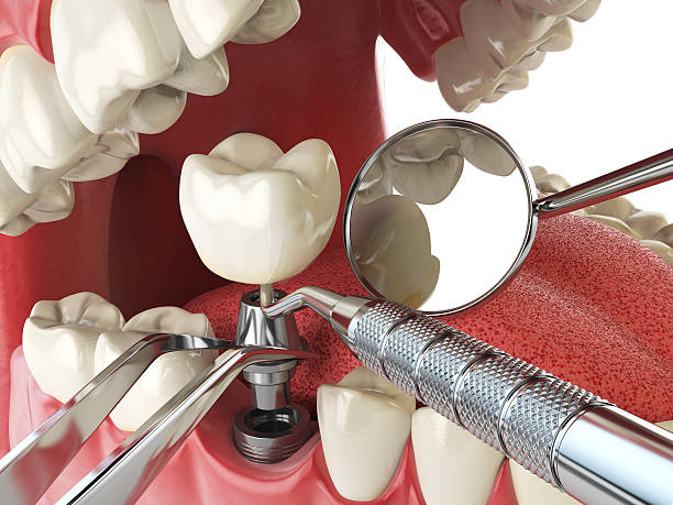Best After-Hours Emergency Dentist in Social Circle, GA